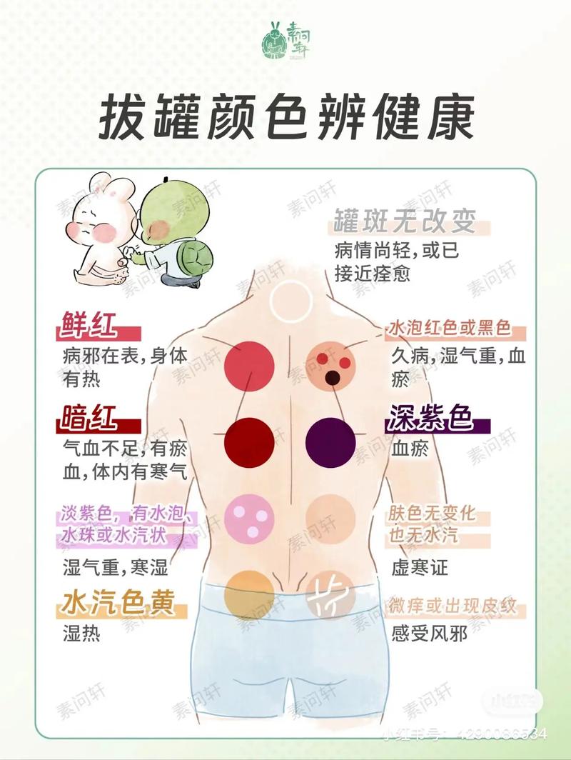 拔罐印颜色揭秘：身体状况与健康预警