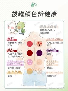 拔罐印颜色揭秘：身体状况与健康预警