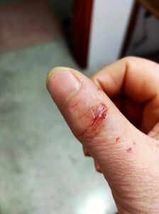 周公解梦：轻松解读梦见被狗咬的含义