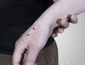 梦中手出血动物咬痕揭秘：梦境寓意与心理映射