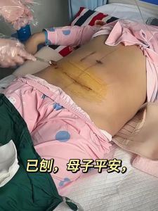 梦境怀孕解析：揭秘心理生理奥秘及缓解初期不适