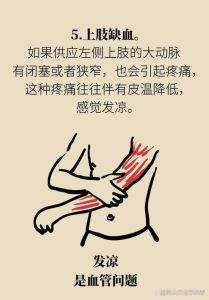 梦境蛇咬左臂：揭秘诡异预兆与深层含义