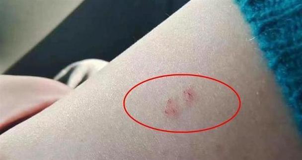 梦境揭秘：蛇咬手臂的寓意与健康财富启示