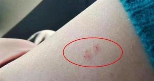 梦境揭秘：蛇咬手臂的寓意与健康财富启示