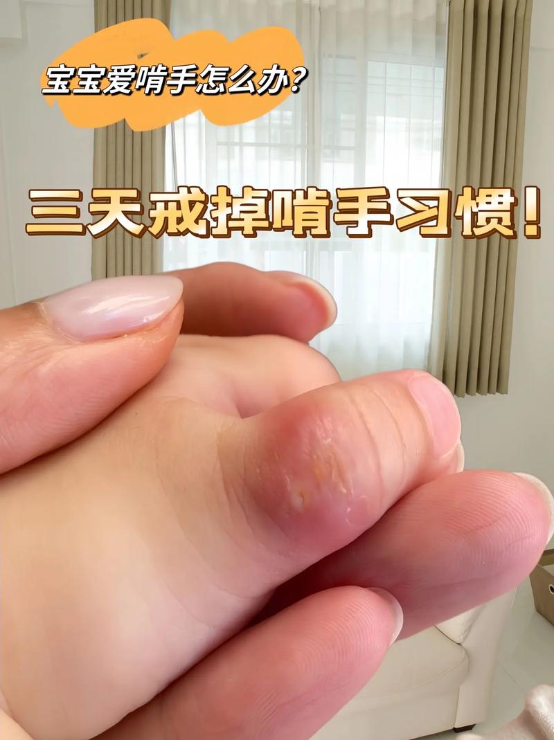 咬手指：揭秘命运与手指的神秘联系