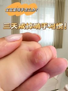 咬手指：揭秘命运与手指的神秘联系