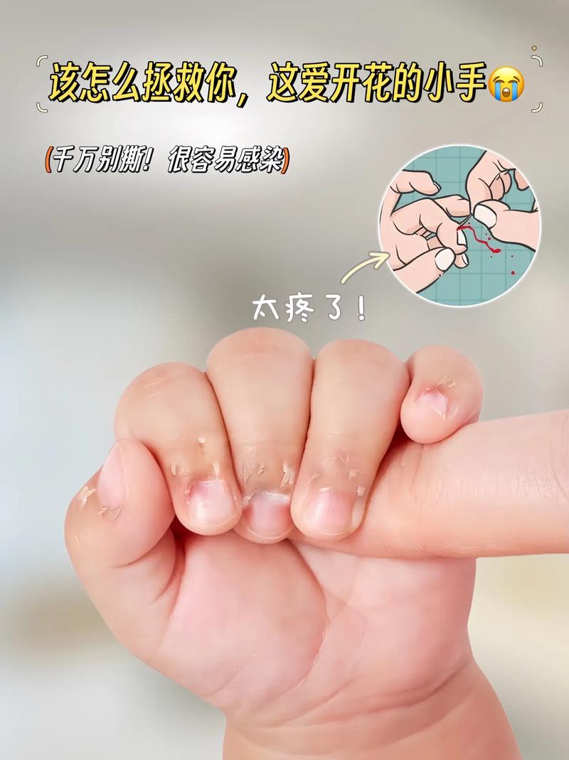 揭秘：女人梦见咬手预示，心理暗示大揭秘！