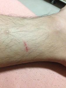 梦境狗狗咬痕揭秘：已婚女小腿咬痕预兆七大人生奥秘