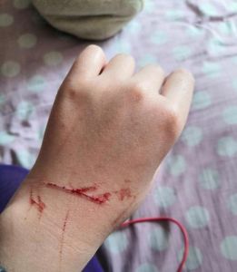 梦境猫咬手揭秘：潜意识保护与生活启示