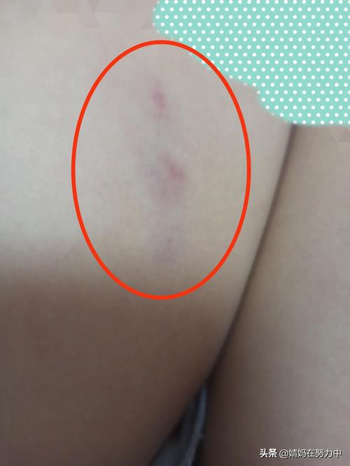 周公解梦：狗咬梦的吉凶解析与象征意义