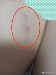 周公解梦：狗咬梦的吉凶解析与象征意义