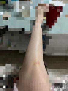 女人梦狗咬小腿出血：揭秘梦境背后的深层含义