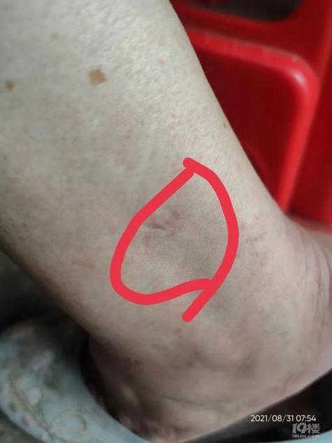 梦狗咬出血：人际关系裂痕的潜意识警示