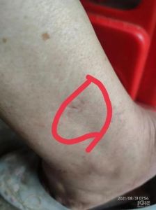 梦狗咬出血：人际关系裂痕的潜意识警示