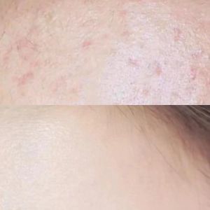 女生多梦根源及改善睡眠攻略