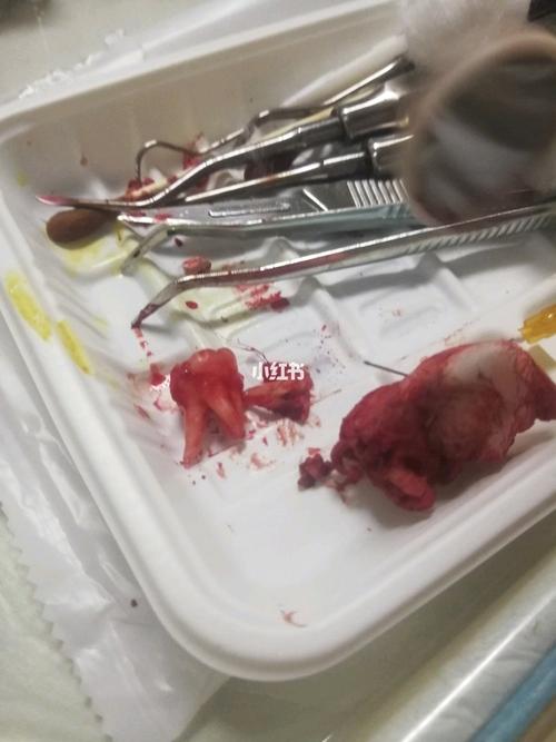揭秘手机充电汽车怠速与性健康：日常行为背后的科学秘密
