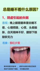 走出失眠困扰：揭秘原因与治疗策略