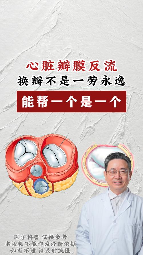 心脏瓣膜变黑怎么办？全方位治疗与康复之道