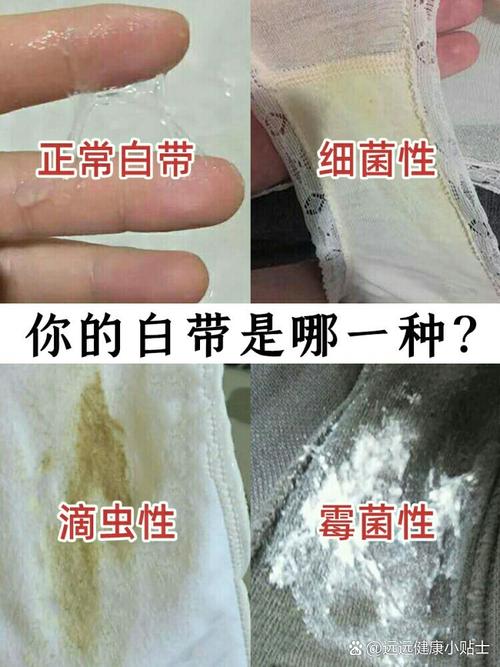 他经常吃我的白带：平衡亲密与健康之道