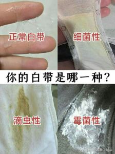 他经常吃我的白带：平衡亲密与健康之道