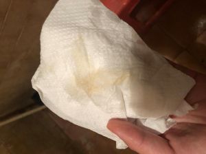解密梦境流血：预示痛苦还是好运？