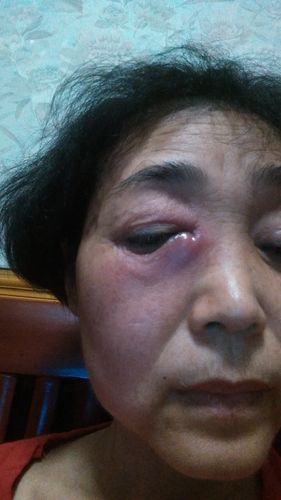 揭秘右眼抽搐：原因与应对策略