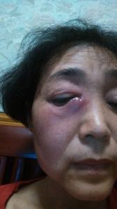 揭秘右眼抽搐：原因与应对策略