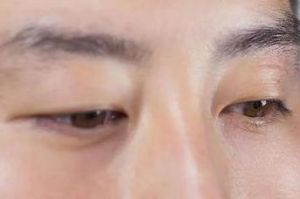 男人右眼皮跳：民俗象征与科学解析