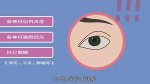 揭秘眼皮跳：民间吉凶与医学解释