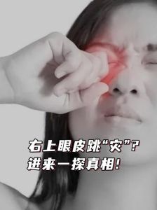 眼皮跳真相揭秘：科学解析与迷信辨析