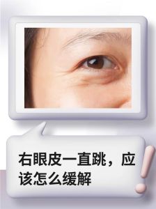 缓解眼皮跳动：原因及多种缓解方法全解析