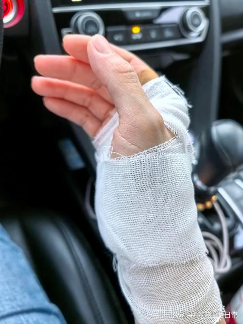 揭秘：为何有人能左手触背而右手不能，肩部活动限制解析