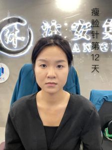 瘦脸针不对称解决秘籍：重拾完美小脸