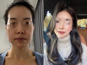 中年肌肤松弛改善秘籍：重拾青春，找回自信笑容