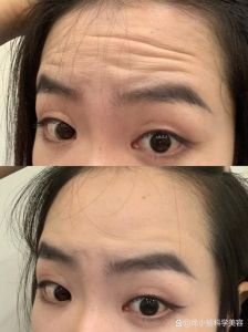 42岁无皱纹秘籍：男士护肤去皱攻略大揭秘！