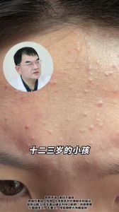 额头胎记：神仙印记揭秘，命运密码探寻