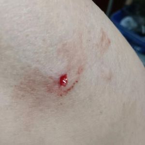 解密梦境：蚂蟥钻肉梦境预示吉凶？