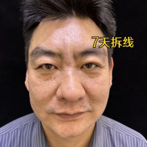 拖鞋隐患揭秘：健康风险与行车安全须知