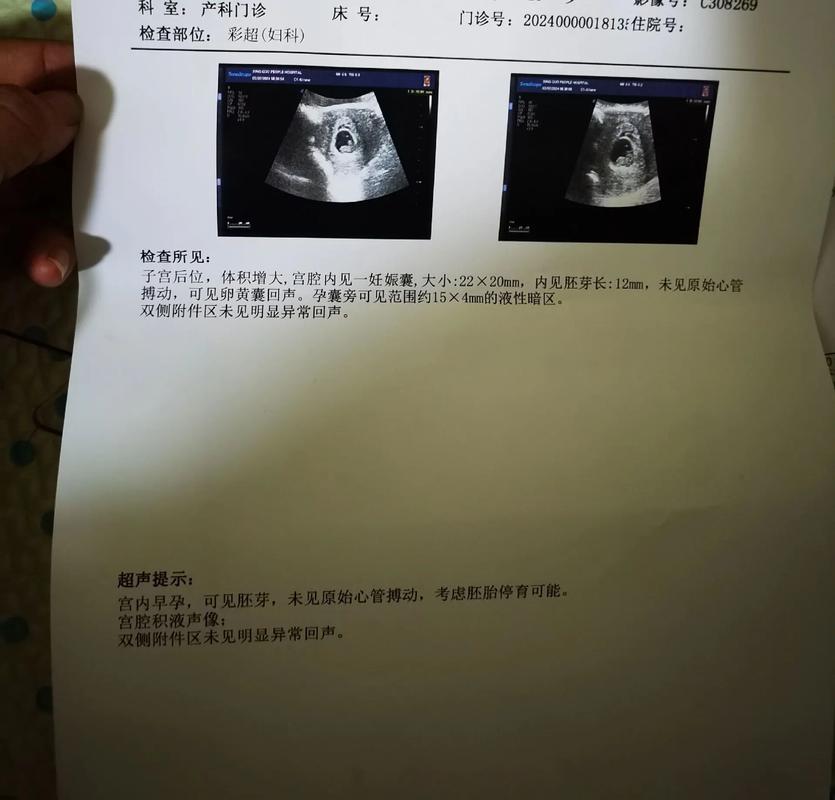 揭秘胎停梦境：预示与启示深层含义