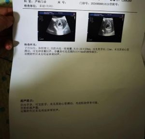 揭秘胎停梦境：预示与启示深层含义