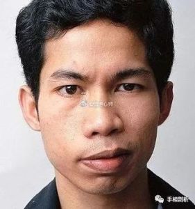 厚唇男性：遗传密码与命运启示