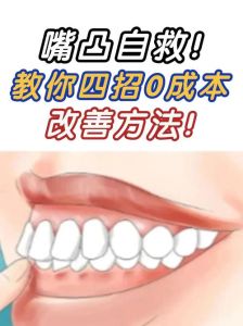下巴改善秘诀：告别嘴凸，自信微笑之旅！