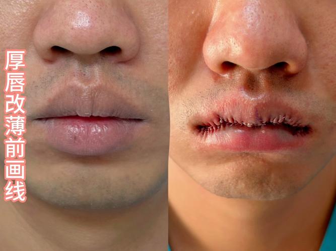 男性唇型性格密码健康线索与美学考究