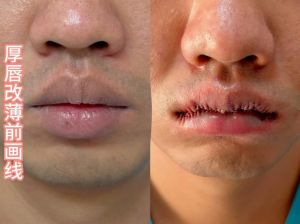 男性唇型性格密码健康线索与美学考究