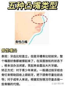 嘴巴突出矫正全攻略：选择最适合你的方法！