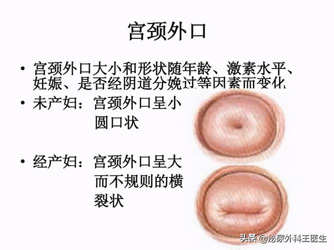 怀孕终止争议：手术安全与避孕智慧解析