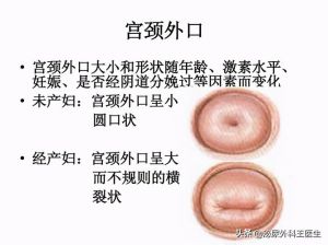 怀孕终止争议：手术安全与避孕智慧解析