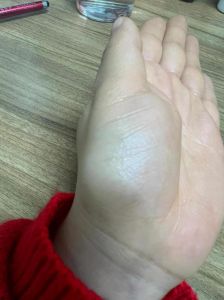 手掌心薄：手相学中的健康与命运奥秘