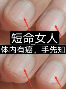 女性短命三大特点及长寿策略