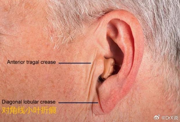 面相四大特征预示寿命长短！